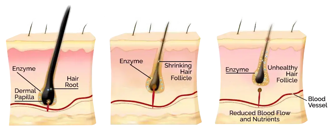 Alt Image